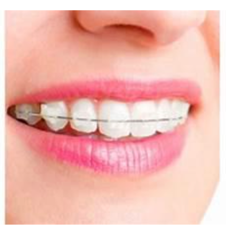 Invisalign Orthodontist